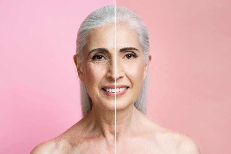 zwei Gesichter einer älteren Dame vor und nach treatment exosomen