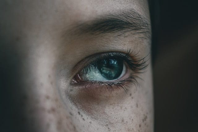 Sommersprossen und klarer Blick