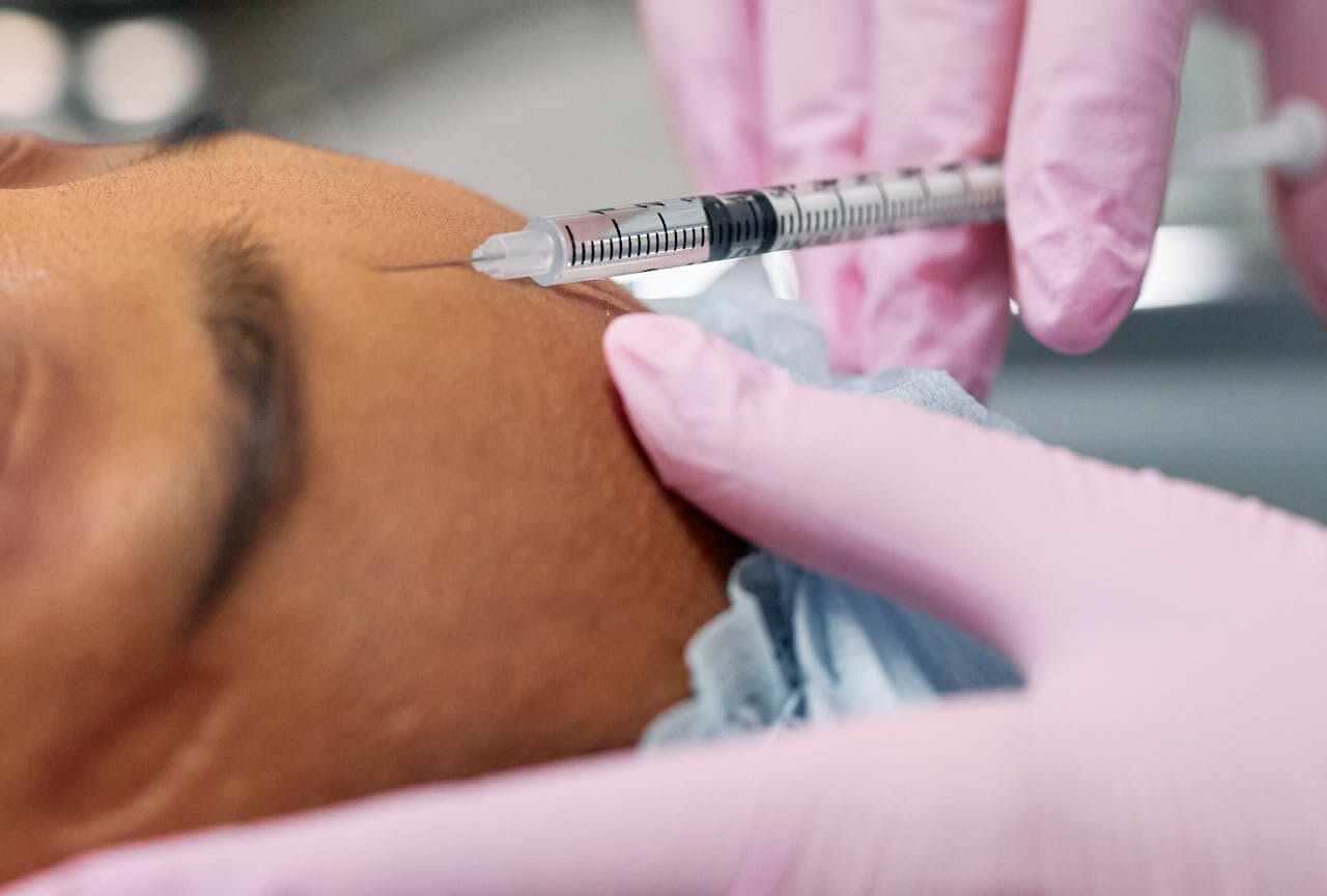 Injektion Stirnfalte