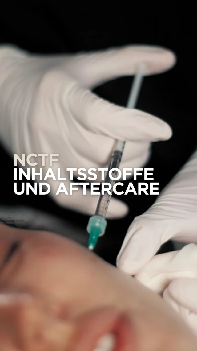 Wann sieht man eigentlich den Effekt von NCTF? ✨

Das Spannende: Einen ersten Soforteffekt kann man bereits nach der Behandlung sehen. Durch die enthaltene unvernetzte Hyaluronsäure wirkt die Haut direkt hydratisierter und frischer. 🤍

Der langfristige Effekt braucht dagegen etwas mehr Geduld. Die Kollagenproduktion ist ein natürlicher Prozess – der kollagenstimulierende Effekt wird deshalb ungefähr nach 30 Tagen sichtbar. 🧬✨

Für ein optimales Behandlungskonzept werden häufig 3 Behandlungen im Abstand von etwa 4 Wochen empfohlen. Danach kann sich der vollständige Effekt der Behandlung zeigen.

#NCTF #SkinBooster #Kollagenstimulation #GlowySkin #Schönheit2go